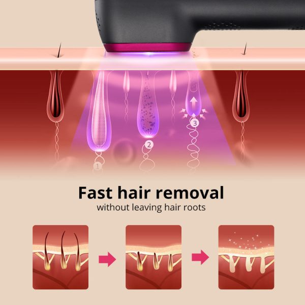 1PCS Laser Hair Removal For Women And Man 100,000 Flashes IPL Painless Laser Hair Removal - Image 3